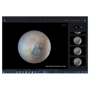 Máy nội soi Tai Mũi Họng Máy nội soi Tai Mũi Họng